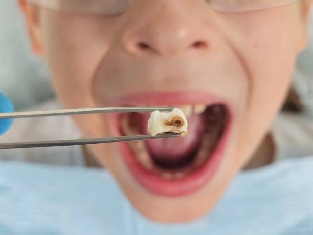 Best 24-Hour Emergency Dental Care in New London, OH